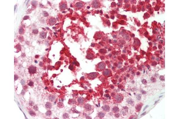 FGD1 antibody  (C-Term)