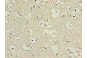 Immunohistochemistry of paraffin-embedded human brain tissue using ABIN7147813 at dilution of 1:100 (CMTM5 antibody  (AA 1-35))