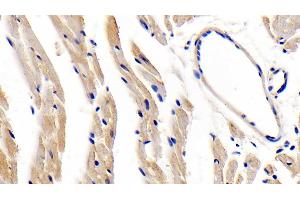 Immunohistochemistry (IHC) image for anti-Leptin Receptor (LEPR) (AA 22-203) antibody (ABIN7430876)