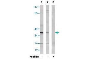 Western blot analysis of extracts from MCF-7 cells (Lane 1 and lane 3) and HepG2 cells (Lane 2), using NT5C1A polyclonal antibody .