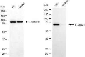 Western blotting analysis using FBXO21 antibody (ABIN7798555). (FBXO21 antibody)