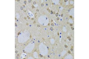 Immunohistochemistry of paraffin-embedded mouse brain using YWHAZ antibody (ABIN5975846) at dilution of 1/100 (40x lens). (14-3-3 zeta antibody)