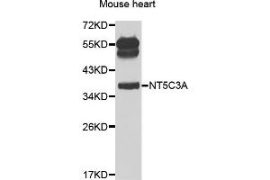 Western blot analysis of extracts of mouse heart, using NT5C3A antibody (ABIN2564236) at 1:1000 dilution.