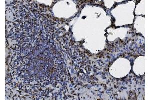 IHC analysis of hnRNP D/AUF1/HNRNPD using anti-hnRNP D/AUF1/HNRNPD antibody (ABIN7602591). (HNRNPD/AUF1 antibody  (AA 88-246))