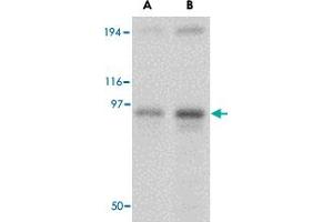 Western blot analysis of NUP107 in A-549 cell lysate with NUP107 polyclonal antibody  at (A) 1 and (B) 2 ug/mL . (NUP107 antibody  (Internal Region))