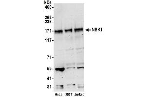 Western Blotting (WB) image for anti-NIMA-Related Kinase 1 (NEK1) (AA 1208-1258) antibody (ABIN7453140)