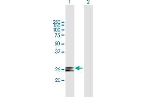 Western Blot analysis of HSCB expression in transfected 293T cell line by HSCB MaxPab polyclonal antibody. (HSCB antibody  (AA 1-235))