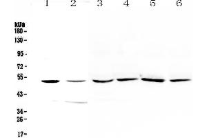 Western blot analysis of HGD using anti-HGD antibody .