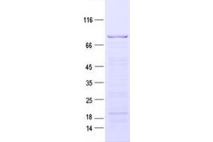 Validation with Western Blot