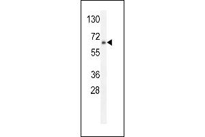 ZNF30 Antibody (N-term) (ABIN654563 and ABIN2844269) western blot analysis in HL-60 cell line lysates (35 μg/lane). (ZFP30 antibody  (N-Term))