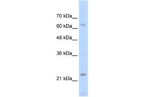 WB Suggested Anti-TNNI1 Antibody Titration:  2. (TNNI1 antibody  (Middle Region))