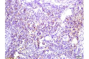 Formalin-fixed and paraffin embedded mouse spleen labeled with Anti-Phospho-p56Dok2 (Tyr142)Polyclonal Antibody, Unconjugated (ABIN684178) at 1:200 followed by conjugation to the secondary antibody and DAB staining