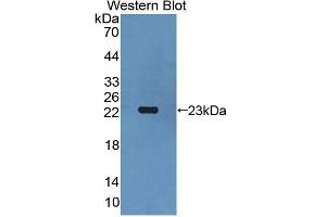 Western Blotting (WB) image for anti-Gremlin 1 (GREM1) antibody (Biotin) (ABIN1175538) (GREM1 antibody  (Biotin))