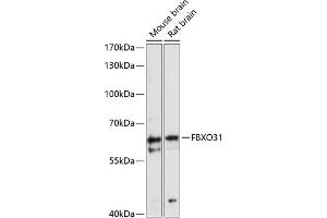 Western blot analysis of extracts of various cell lines, using FBXO31 antibody (ABIN6129682, ABIN6140518, ABIN6140519 and ABIN6216685) at 1:3000 dilution.
