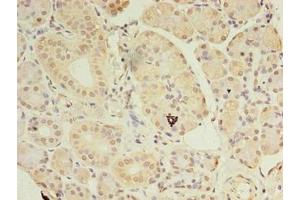 Immunohistochemistry of paraffin-embedded human pancreatic tissue using ABIN7144199 at dilution of 1:100 (ASB8 antibody  (AA 12-288))