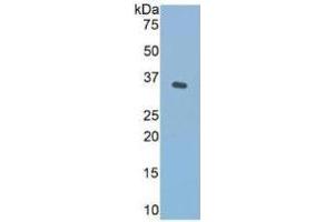 WB of Protein Standard: different control antibodies against Highly purified E. (Fibronectin CLIA Kit)