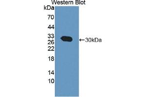Detection of Recombinant CACYBP, Human using Polyclonal Antibody to Calcyclin Binding Protein (CACYBP) (CACYBP antibody  (AA 2-228))