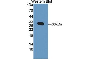 Detection of Recombinant CACYBP, Human using Polyclonal Antibody to Calcyclin Binding Protein (CACYBP)