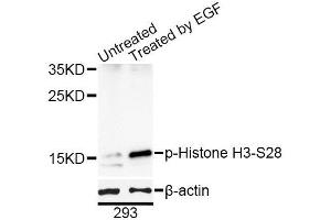 Western blot analysis of extracts of 293T cells, using Phospho-Histone H3-S28 antibody (ABIN5969937) at 1/1000 dilution. (Histone H3.1 antibody  (pSer29))