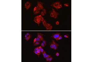 Immunofluorescence analysis of MCF7 cells using SLC7 Rabbit pAb (ABIN3016800, ABIN3016801, ABIN1682793 and ABIN6219842) at dilution of 1:300 (40x lens). (SLC7A5 antibody  (AA 1-125))