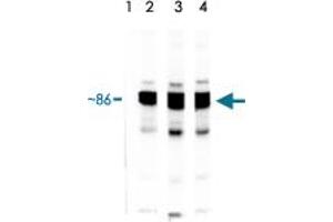 Lane 1 : HSP90 protein standard stressgen. (HSP90 alpha/beta antibody)