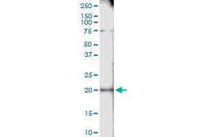 Immunoprecipitation of CETN1 transfected lysate using anti-CETN1 MaxPab rabbit polyclonal antibody and Protein A Magnetic Bead , and immunoblotted with CETN1 purified MaxPab mouse polyclonal antibody (B01P) . (Centrin 1 antibody  (AA 1-172))
