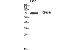 Western Blot (WB) analysis of K562 using CD156c antibody.