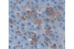 Figure. (CPT2 antibody  (AA 452-658))