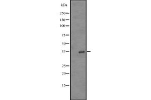 Western blot analysis of OR52Z1P expression in K562 cell line lysates ;,The lane on the left is treated with the antigen-specific peptide. (OR52Z1 antibody)