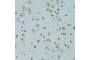 Immunohistochemistry of paraffin-embedded rat brain using MUS81 antibody (ABIN6132372, ABIN6144202, ABIN6144203 and ABIN6222560) at dilution of 1:100 (40x lens). (MUS81 antibody  (AA 1-350))