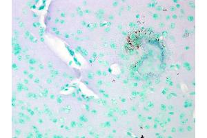 Immunohistochemistry analysis using Mouse Anti-CaV1.