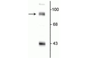 Western blot of rat hippocampal lysate showing specific immunolabeling of the ~95 kDa PSD-95 protein. (DLG4 antibody  (N-Term))