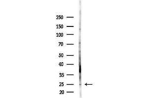 anti-Nucleolar Protein 12 (NOL12) (C-Term) antibody
