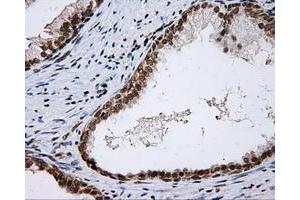 Immunohistochemical staining of paraffin-embedded colon tissue using anti-SHC1 mouse monoclonal antibody.