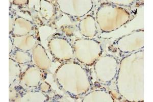 Immunohistochemistry of paraffin-embedded human thyroid tissue using ABIN7165103 at dilution of 1:100 (ARMCX6 antibody  (AA 28-300))