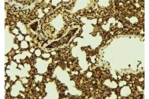 ABIN6267141 at 1/100 staining Mouse lung tissue by IHC-P.
