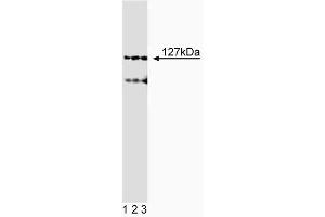 Western blot analysis of Adaptin epsilon on SK-MEL5 lysate.