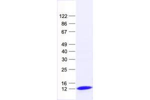FCF1 Protein (His tag)
