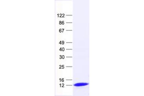 FCF1 Protein (His tag)