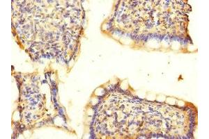 Immunohistochemistry of paraffin-embedded human small intestine tissue using ABIN7143005 at dilution of 1:100 (ACCN5 antibody  (AA 140-330))