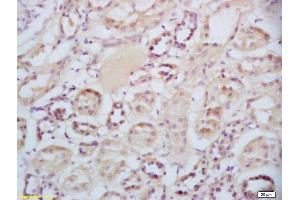 Formalin-fixed and paraffin embedded human kidney labeled with Rabbit Anti-Sclerostin Polyclonal Antibody, Unconjugated (ABIN1714867) at 1:200 followed by conjugation to the secondary antibody and DAB staining (Sclerostin antibody  (AA 121-180))