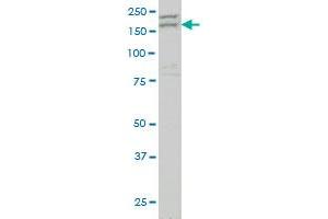 AATK monoclonal antibody (M04), clone 2C8 Western Blot analysis of AATK expression in NIH/3T3 . (AATK antibody  (AA 161-260))