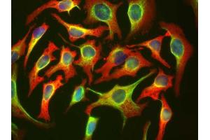 HeLa cells staining with ABIN1580426 (red), and counterstained with ’s chicken polyclonal antibody to Vimentin CPCA-Vim (green) and DNA (blue). (HSP27 antibody)