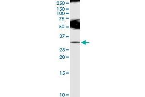 Immunoprecipitation of SLC5A1 transfected lysate using anti-SLC5A1 MaxPab rabbit polyclonal antibody and Protein A Magnetic Bead , and immunoblotted with SLC5A1 MaxPab rabbit polyclonal antibody (D01) (SLC5A1 antibody  (AA 1-664))