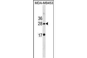 Western blot analysis in MDA-MB453 cell line lysates (35ug/lane). (CLDN14 antibody  (C-Term))