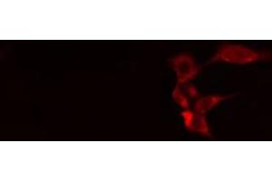 ABIN6268984 staining 293 cells by IF/ICC. (Caspase 1 antibody  (pSer376))
