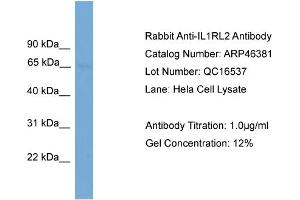 WB Suggested Anti-IL1RL2  Antibody Titration: 0. (IL1RL2 antibody  (N-Term))