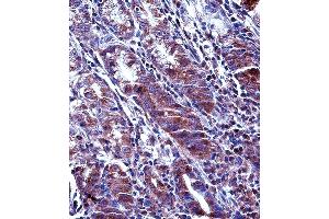 MCL1 Antibody (Center) (ABIN657627 and ABIN2846623) immunohistochemistry analysis in formalin fixed and paraffin embedded human stomach tissue followed by peroxidase conjugation of the secondary antibody and DAB staining. (MCL-1 antibody  (AA 217-245))