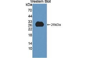 Figure. (ANGPTL6 antibody  (AA 257-470))