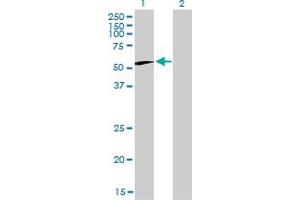 Western Blot analysis of CCT6B expression in transfected 293T cell line by CCT6B monoclonal antibody (M01), clone 1A4. (CCT6B antibody  (AA 1-530))